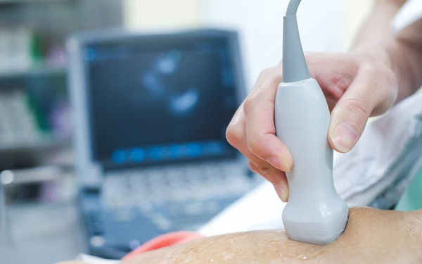 Echocardiogram Mesa AZ