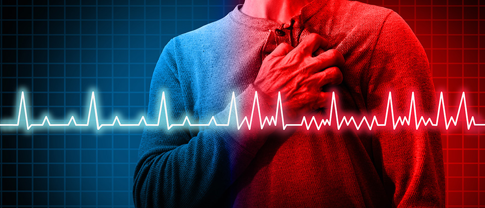 Living with Atrial Fibrillation: Tips for Daily Life
