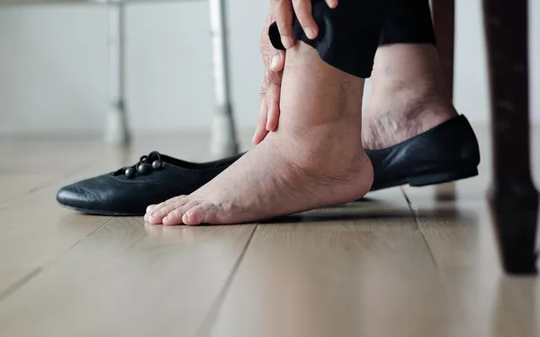 May-Thurner Syndrome Specialist Mesa AZ