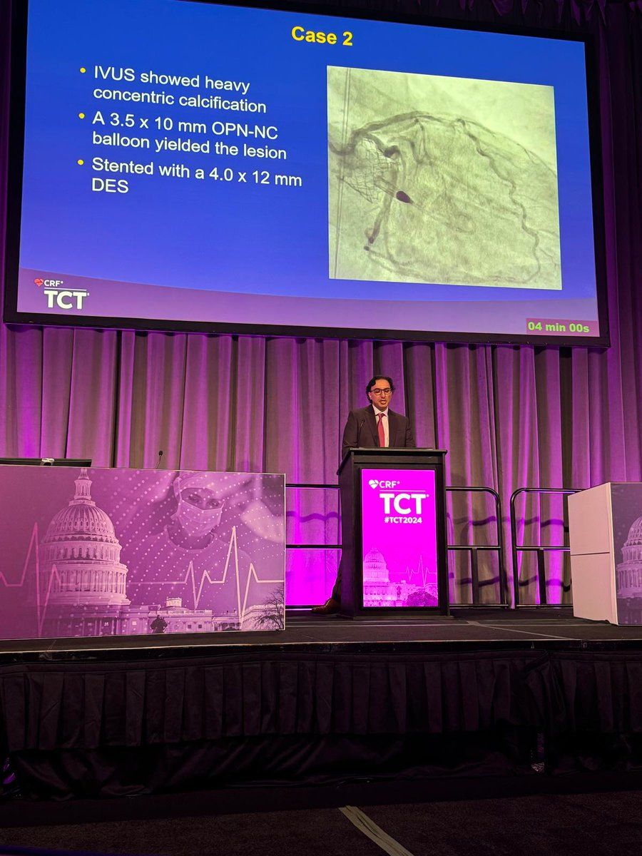 Dr. Patel presenting a coronary case at the TCT podium.